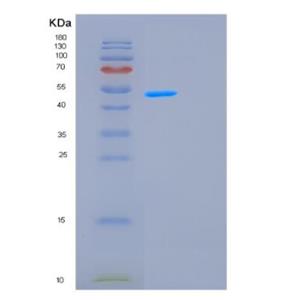 Recombinant Human GCN5L2 Protein,Recombinant Human GCN5L2 Protein