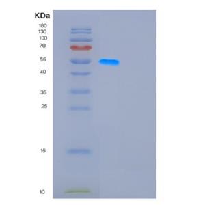 Recombinant Human GDA Protein,Recombinant Human GDA Protein