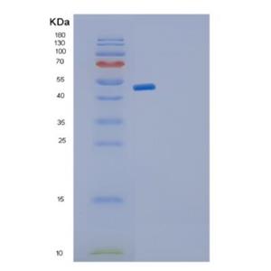 Recombinant Human GDI2 Protein