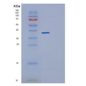 Recombinant Human GET4 Protein