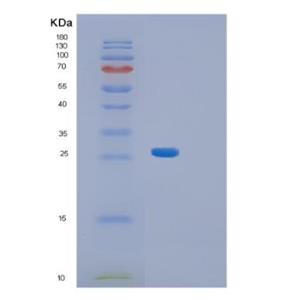 Recombinant Human Aequorea victoriaGFP Protein,Recombinant Human Aequorea victoriaGFP Protein