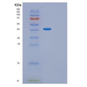 Recombinant Human GFPT1 Protein