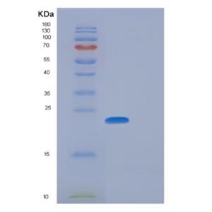 Recombinant Human GGCT Protein,Recombinant Human GGCT Protein