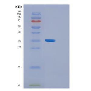 Recombinant Human GGH Protein,Recombinant Human GGH Protein