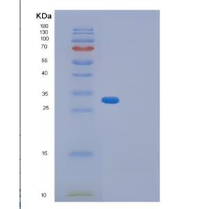 Recombinant Human GID8 Protein,Recombinant Human GID8 Protein