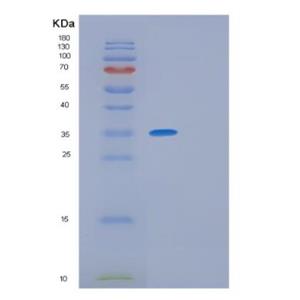 Recombinant Human GIMAP6 Protein,Recombinant Human GIMAP6 Protein