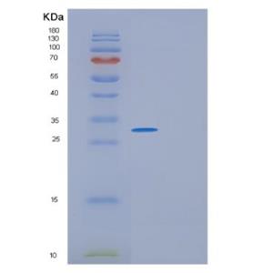 Recombinant Human GINS4 Protein,Recombinant Human GINS4 Protein