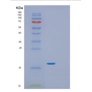 Recombinant Human GIP Protein,Recombinant Human GIP Protein