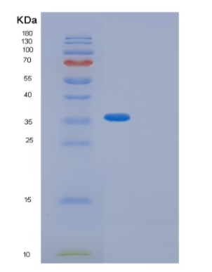 Recombinant Human GIPC2 Protein,Recombinant Human GIPC2 Protein