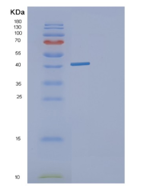 Recombinant E. coligldA Protein,Recombinant E. coligldA Protein