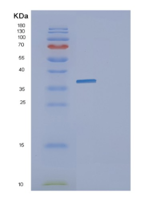 Recombinant E.coli glk Protein,Recombinant E.coli glk Protein