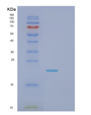 Recombinant Mouse Glo1 Protein,Recombinant Mouse Glo1 Protein