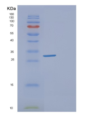 Recombinant Saccharomyces cerevisiaeGLC8 Protein,Recombinant Saccharomyces cerevisiaeGLC8 Protein