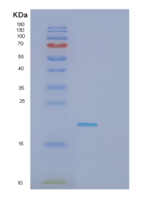 Recombinant Human GLO1 Protein,Recombinant Human GLO1 Protein