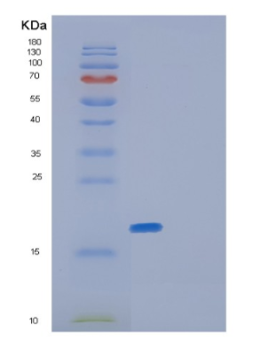 Recombinant Human GLRX5 Protein,Recombinant Human GLRX5 Protein