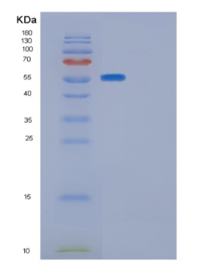 Recombinant Human GLUD1 Protein,Recombinant Human GLUD1 Protein