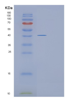 Recombinant Human GLUL Protein,Recombinant Human GLUL Protein