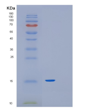 Recombinant Human Glutaredoxin-1 Protein,Recombinant Human Glutaredoxin-1 Protein