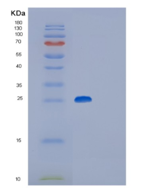 Recombinant Mouse Glutathione S-transferase P 2 Protein,Recombinant Mouse Glutathione S-transferase P 2 Protein