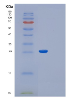 Recombinant Schistosoma japonicum RecombinantGlutathione S-Transferase(GST) Protein,Recombinant Schistosoma japonicum RecombinantGlutathione S-Transferase(GST) Protein