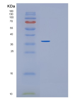 Recombinant Human GLYAT Protein,Recombinant Human GLYAT Protein