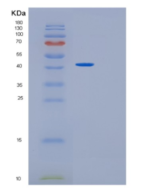 Recombinant Human GMDS Protein,Recombinant Human GMDS Protein