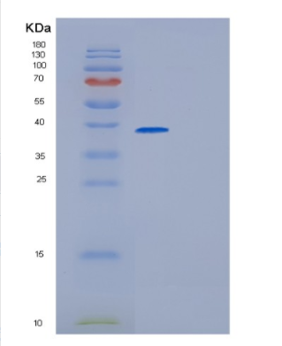 Recombinant Human GMPR Protein,Recombinant Human GMPR Protein