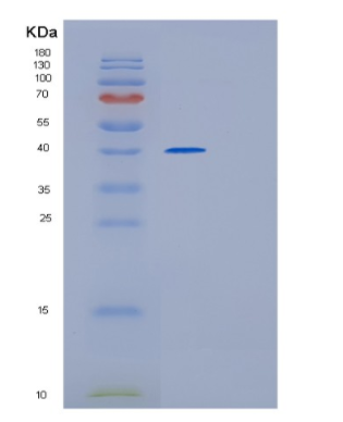 Recombinant Human GMPR2 Protein,Recombinant Human GMPR2 Protein