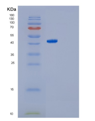 Recombinant Human GNAI1 Protein,Recombinant Human GNAI1 Protein