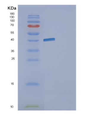 Recombinant E.coli gldA Protein,Recombinant E.coli gldA Protein