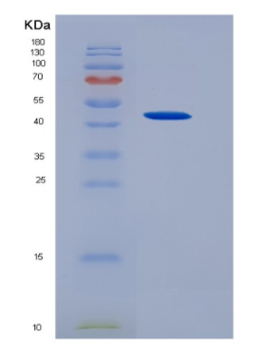 Recombinant Colony Stimulating Factor 2, Granulocyte Macrophage (GM-CSF),Recombinant Colony Stimulating Factor 2, Granulocyte Macrophage (GM-CSF)