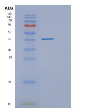 Recombinant Human GNB3 Protein,Recombinant Human GNB3 Protein