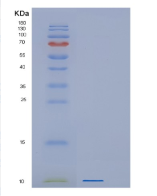 Recombinant Human GNG13 Protein,Recombinant Human GNG13 Protein