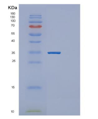 Recombinant Human GNMT Protein,Recombinant Human GNMT Protein