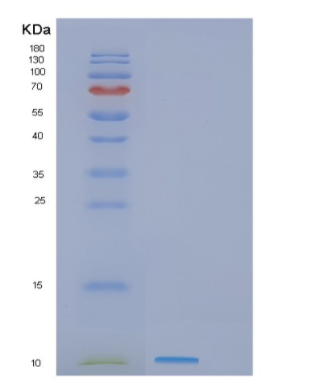 Recombinant Human GNRH1 Protein,Recombinant Human GNRH1 Protein