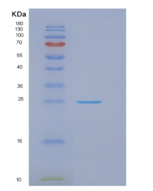 Recombinant Human GOSR2 Protein,Recombinant Human GOSR2 Protein