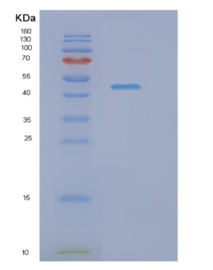 Recombinant Human GOT2 Protein,Recombinant Human GOT2 Protein