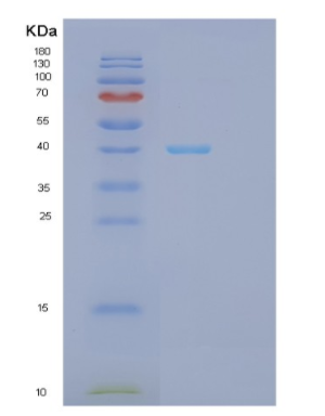 Recombinant Human GPD1L Protein,Recombinant Human GPD1L Protein