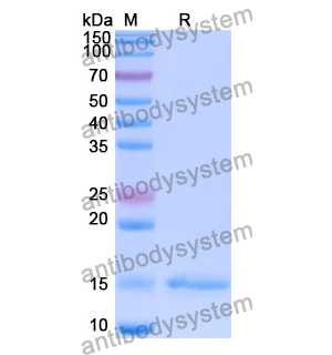 抗 Human CD212/IL12RB1 納米抗體 (SAA1300)(RHE37101),Anti-Human CD212/IL12RB1 Nanobody (SAA1300)