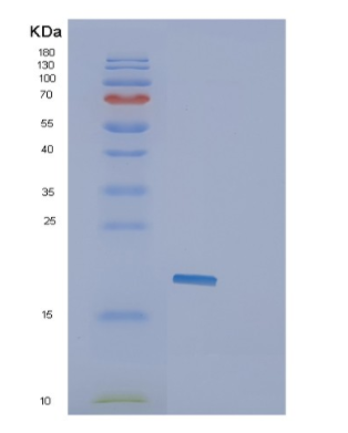 Recombinant Human GLIPR2 Protein,Recombinant Human GLIPR2 Protein