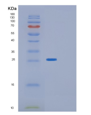 Recombinant Human GLTPD1 Protein,Recombinant Human GLTPD1 Protein