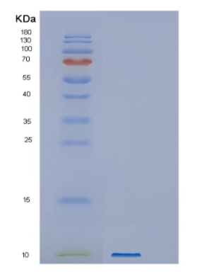 Recombinant Human GNG12 Protein,Recombinant Human GNG12 Protein