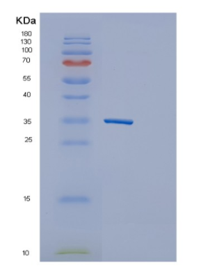 Recombinant Human GNPDA1 Protein,Recombinant Human GNPDA1 Protein