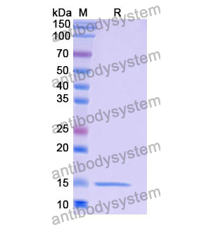 抗 Human LYZ 納米抗體 (SAA1112)(RHF45704),Anti-Human LYZ Nanobody (SAA1112)