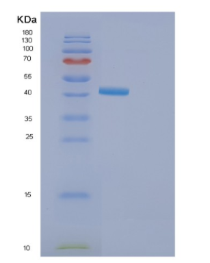 Recombinant Human GOLM1 Protein,Recombinant Human GOLM1 Protein