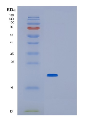 Recombinant Human Glyoxalase I Protein,Recombinant Human Glyoxalase I Protein