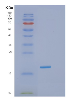 Recombinant Human GOLGA7 Protein,Recombinant Human GOLGA7 Protein