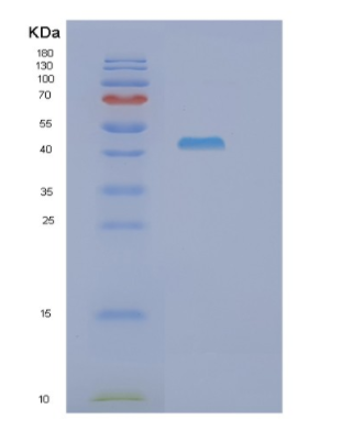 Recombinant Human GOT1 Protein,Recombinant Human GOT1 Protein