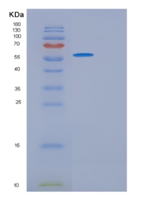 Recombinant Rat Gpt Protein,Recombinant Rat Gpt Protein