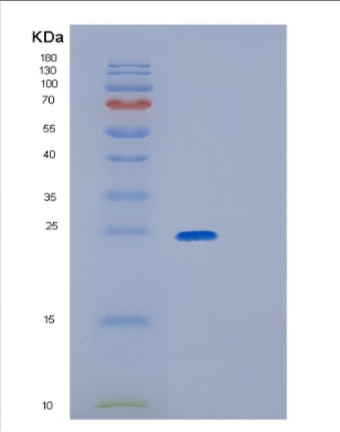 Recombinant Human GPX2(U40C) Protein,Recombinant Human GPX2(U40C) Protein